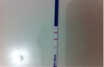 胎停育前兆分泌物圖片及其相關(guān)信息解讀，胎停育前兆分泌物圖片詳解及信息解讀指南