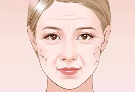 如何有效去除老年斑——全方位解析，全方位解析，有效去除老年斑的方法