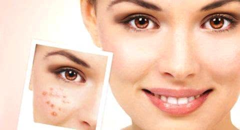 臉上長斑的原因及其影響因素，深度解析，深度解析，臉上長斑的原因及其影響因素