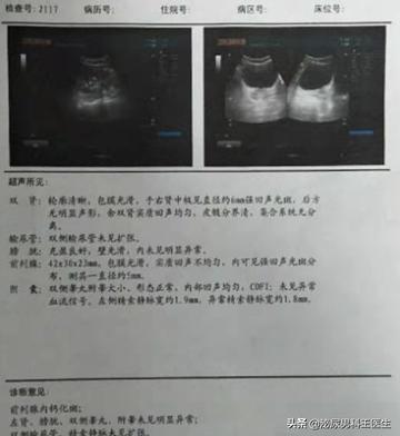 關(guān)于年輕男性前列腺鈣化，了解、應(yīng)對與關(guān)愛，年輕男性前列腺鈣化，認(rèn)知、應(yīng)對與關(guān)愛之道