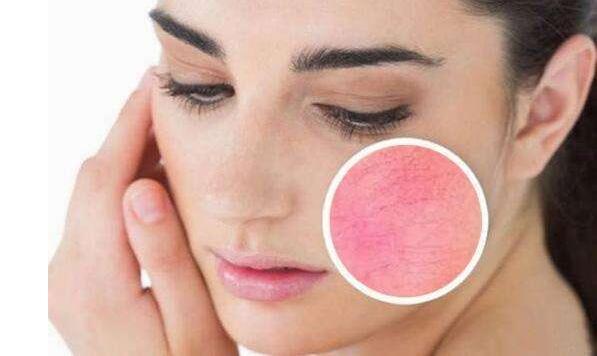 如何有效去除紅血絲，最佳方法與實(shí)用建議，紅血絲去除攻略，最佳方法與實(shí)用建議