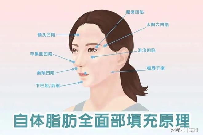 脂肪填充后幾天開始存活，全面解析脂肪填充過程及其恢復(fù)時(shí)間，全面解析脂肪填充過程，術(shù)后幾天脂肪開始存活及恢復(fù)時(shí)間揭秘