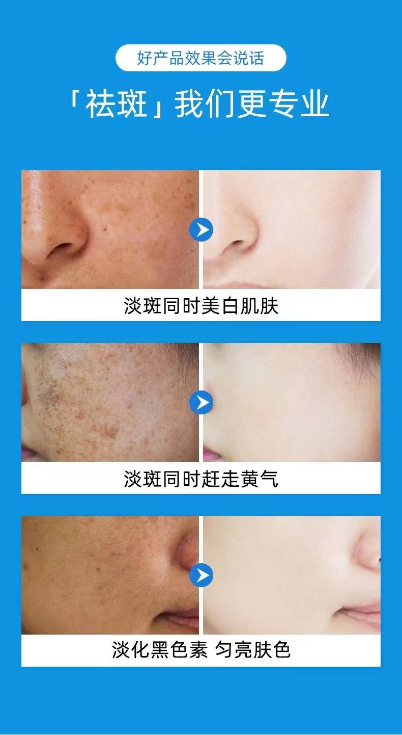 揭秘祛斑最佳方法，如何達(dá)到最佳祛斑效果？，揭秘最佳祛斑方法，實(shí)現(xiàn)最佳效果的秘訣！