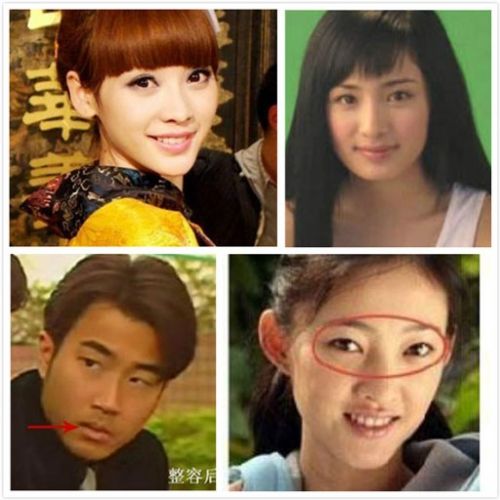 整容失敗明星整容前后圖片，深度探討與反思，整容失敗的明星，前后對比與深度探討反思