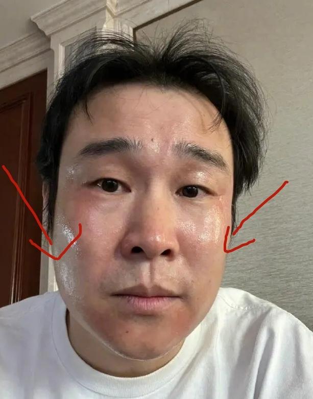 頭痛欲裂，感覺要爆炸了怎么辦？全面解析頭痛原因與應對之策，頭痛欲裂，緊急解析原因與應對之策，全面攻略助你擺脫頭痛困擾